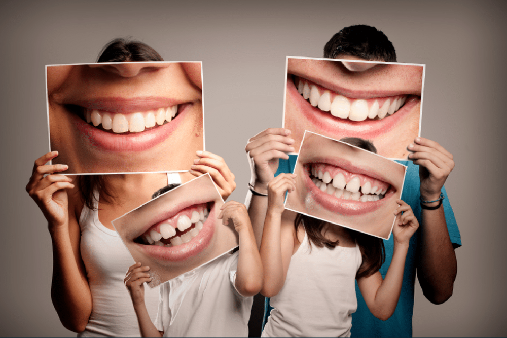 Four people hold large photos of smiling mouths in front of their faces, creating an exaggerated and humorous effect—perfect for showcasing the fun side of pediatric dentistry.